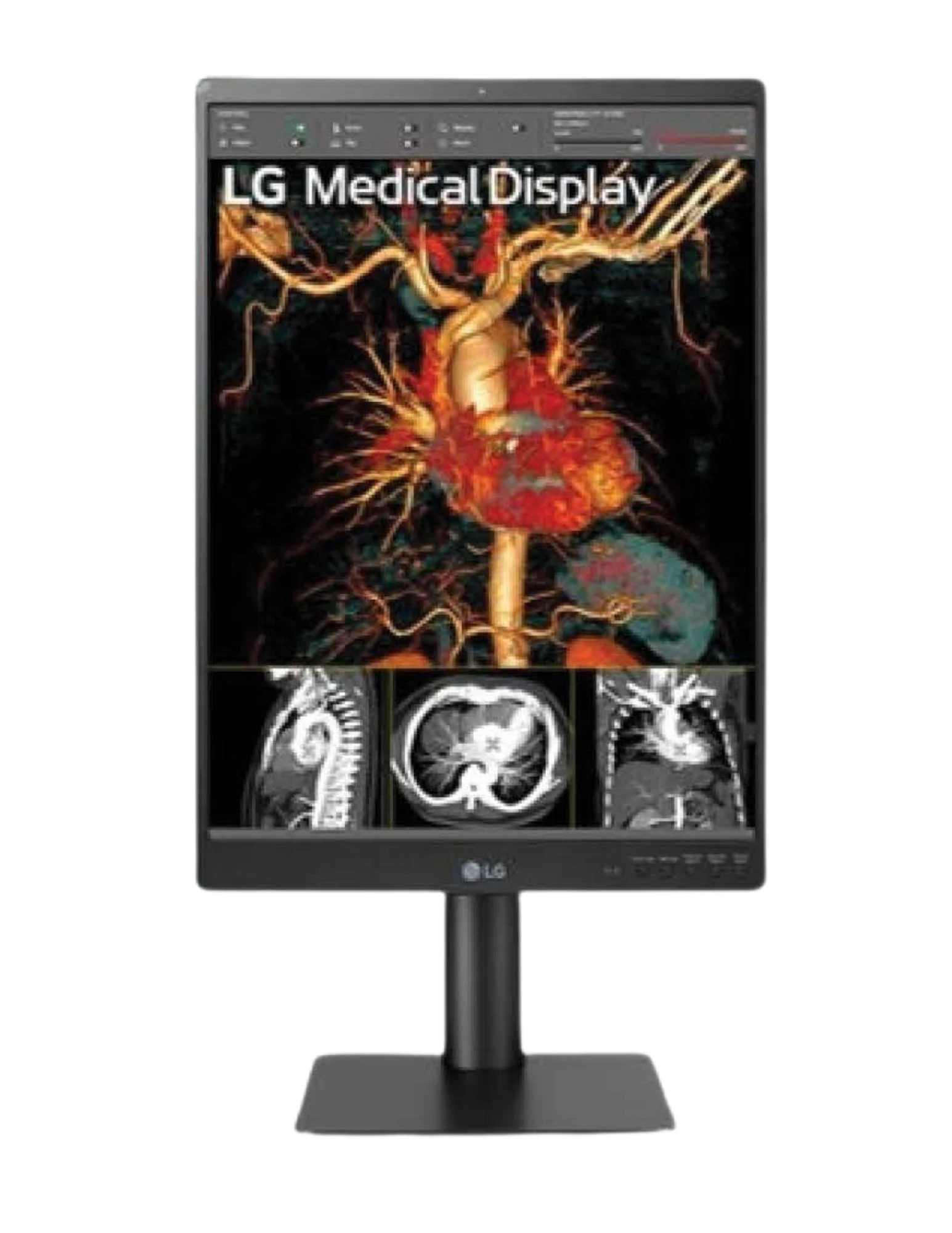 MONITOR DE DIAGNÓSTICO 21HQ513D